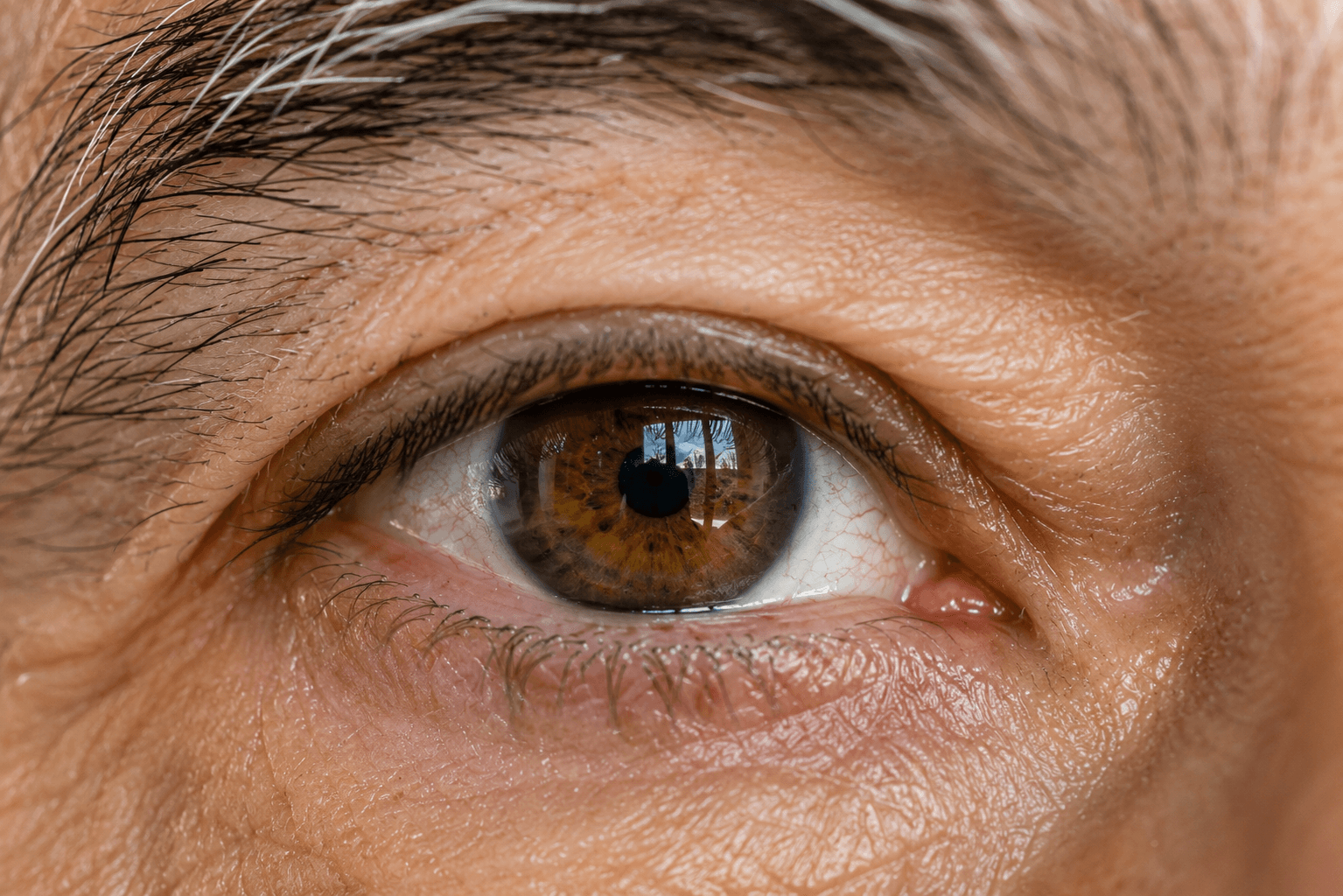 Close-up view of a human eye during ophthalmic examination