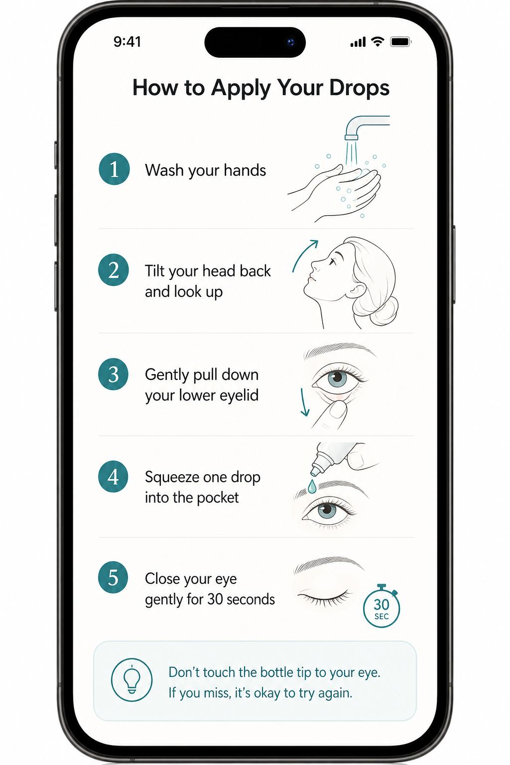 My Cataract Drops how to apply eye drops guide