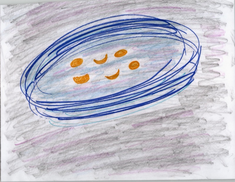 Patient drawing: blue vortex with orange fragments during cataract surgery