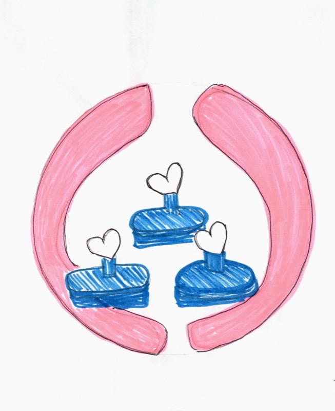 Patient drawing: pink curves with blue shapes and hearts seen during cataract surgery